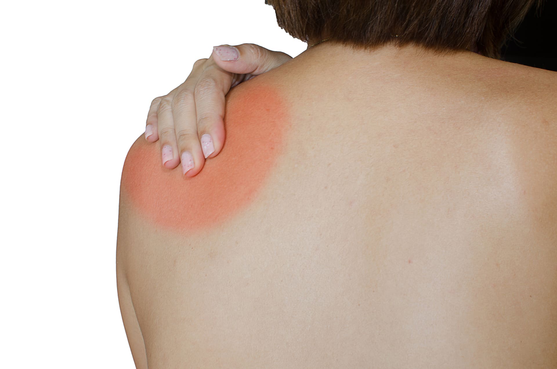 chiropractor treatment shoulder-pain frozen shoulder